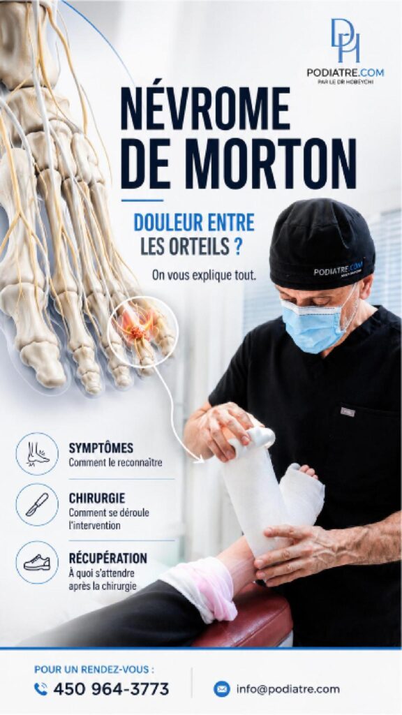 Névrome de Morton: comprendre cette douleur à l’avant-pied